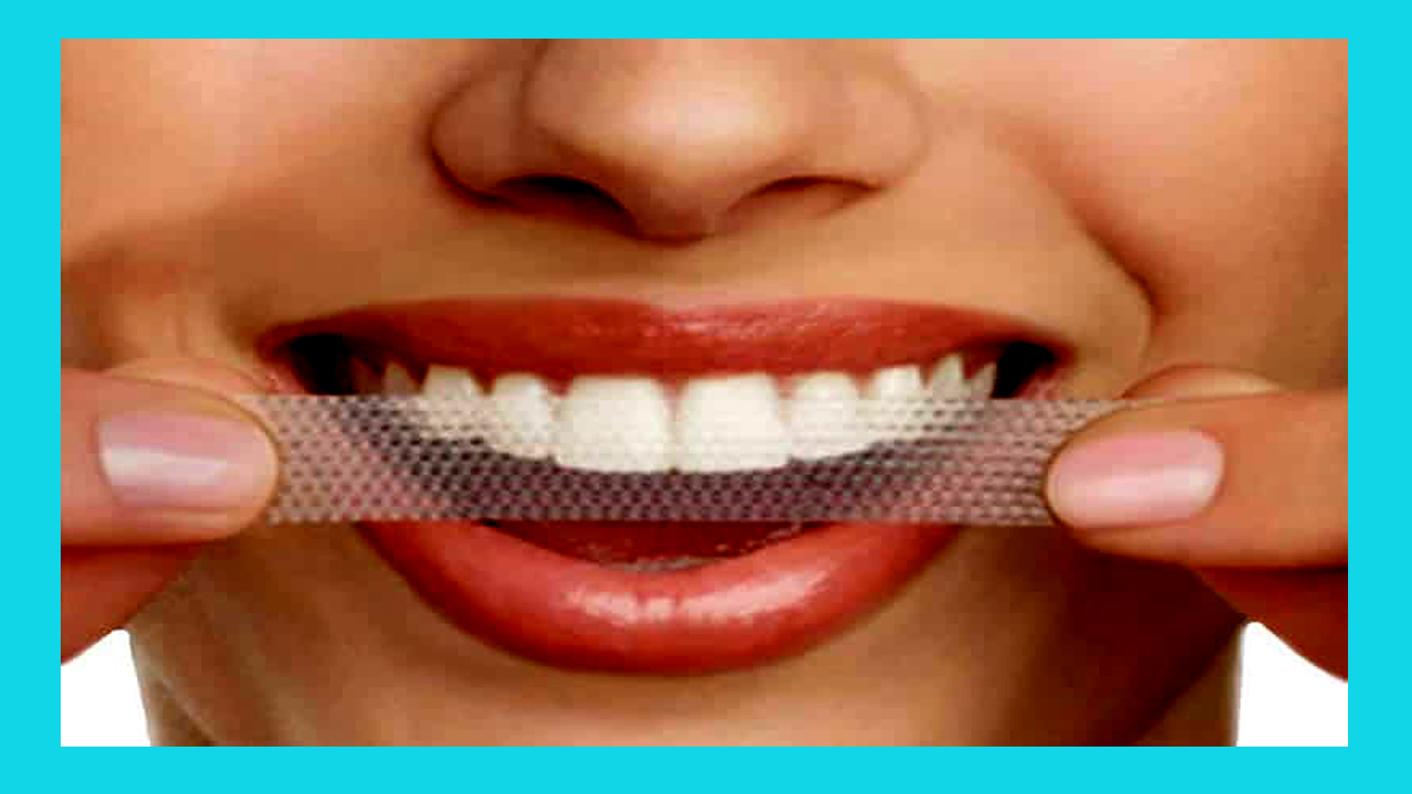 Do teeth whitening strips work